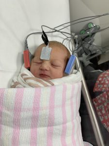 baby with monitor tags on her head